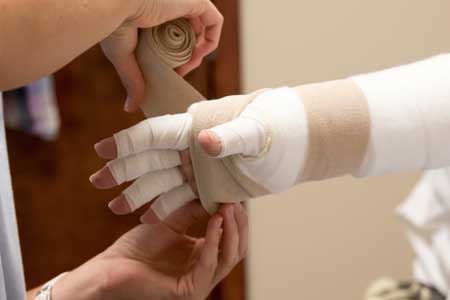 Lymphedema Symptoms