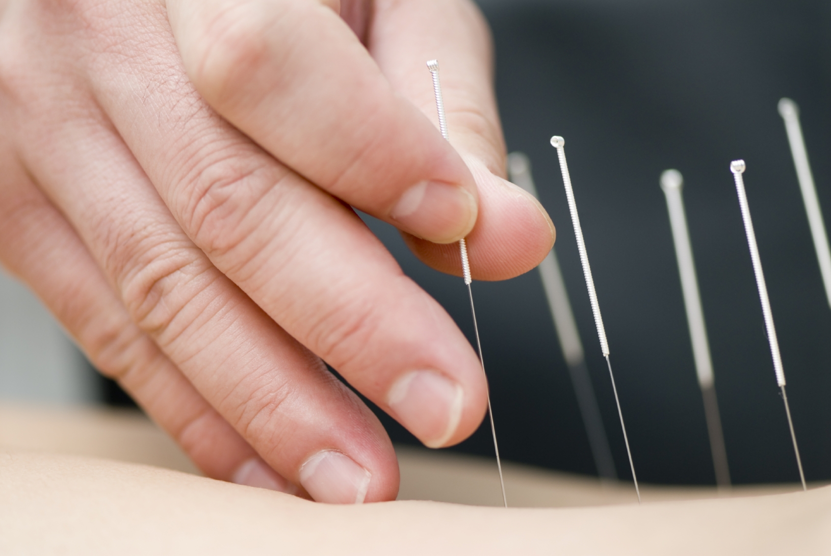 Treatments Offered At London Clinic Varney Physio